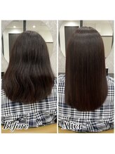 リスター(LISTER)