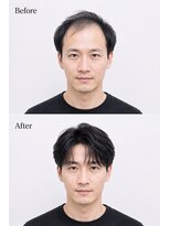 アフィーロ(ACHFILO)&nbsp;前髪エクステ メンズエクステ メンズヘア 髪質改善 印象設計 02