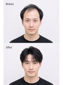 アフィーロ(ACHFILO) 前髪エクステ メンズエクステ メンズヘア 髪質改善 印象設計 02