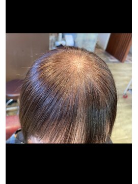 アローズ(arose) 3D増毛