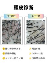 フリーダム 池下店(Freedom)&nbsp;【ヘッドスパ】頭皮ケア　頭皮診断　髪質改善　30代40代50代