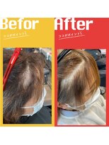 ヘアステージアミカル 縮毛矯正Before after