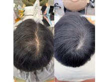 凪の旅先の雰囲気(北海道初!育毛促進、血流改善の頭頭脳プログラム導入店)