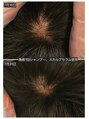 トワエモア バイ ブレス(toi et moi . by BLESS)&nbsp;効果を実感いただくまでにお時間をいただきません！