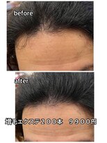 エミ(EMI)&nbsp;増毛エクステ/カッサ/育毛促進ヘッドスパ/ボリュームアップ