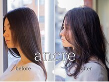 アンクル(ancre)