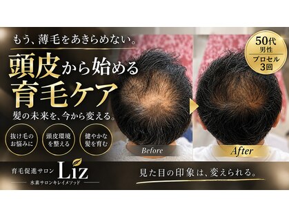 リズ(Liz)の写真