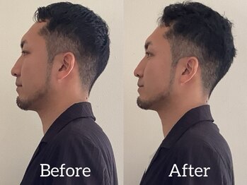 キーネヘアコレクションの写真/立毛筋ケアスパ◇固まった頭皮を解きほぐすことで巡りやリンパの流れをスムーズに◎お顔の印象もすっきり♪