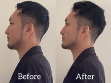 キーネヘアコレクション
