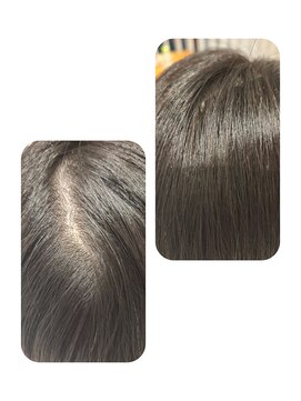 話題のトキカタ♪頭頂部編