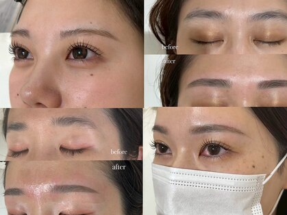 ディティカ ティア(Dityca tia)の写真