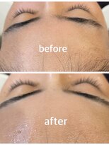 リュリュ(RyuRyu) レディースシェービング