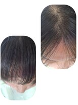 ユーフォルムギンザ(y-Forme Ginza)&nbsp;話題のトキカタ♪前髪編