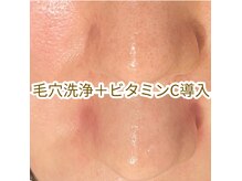 ヘッドスパ専門店 テテ(tete)の雰囲気（紫外線などで目立つ毛穴の黒ずみも毛穴洗浄メニューで解決♪）