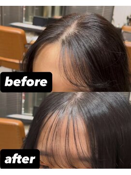 ティダスマイル 吉祥寺店(tida smile) 前髪割れ癖改善パーマ