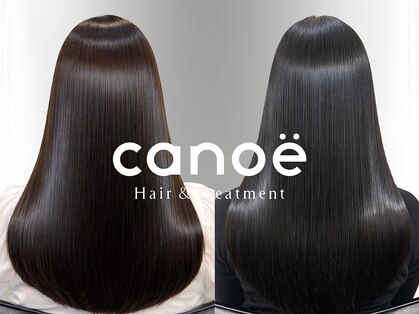 カノエ(canoe)の写真