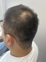 アオ 花咲町(a-o)&nbsp;サッパリソフモヒ