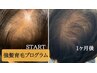 カット＋頭皮改善プログラム【20% or 110%】