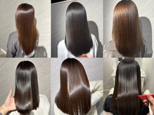 アンベル(ANBEL)