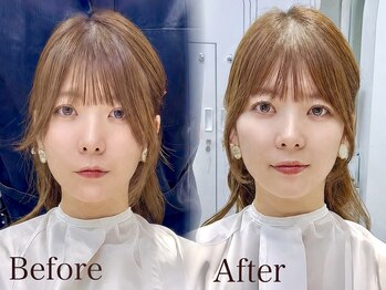 yori Le_trois 札幌大通 ショートボブ/レイヤーカット/メンズカット【6/1～（予定）】の写真/小顔に見える顔周りレイヤーカット/韓国風顔周りデザインまで、史上一番の似合わせを［顔周り/レイヤー］