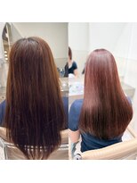 メルス(MeLS)&nbsp;Before→After  06