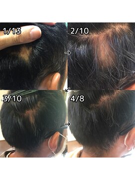 ルーミールーム(RoomieRoom) お悩み解決☆頭皮改善！メンズ育毛促進ケア