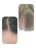 ユーフォルムギンザ(y-Forme Ginza)&nbsp;話題のトキカタ♪前髪編