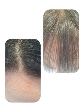 ユーフォルムギンザ(y-Forme Ginza) 話題のトキカタ♪前髪編