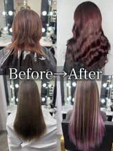 ロズクリア(Roz clear)