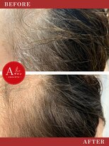 エーサロン(Aサロン)&nbsp;根元染め/白髪染め