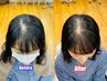 【新大久保】増 毛 エクステ【前髪が少ないのが気になる人向け】600本コース