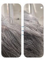 ユーフォルムギンザ(y-Forme Ginza)&nbsp;話題のトキカタ♪頭頂部編