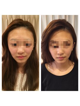 アドール(ADOR) 小顔コルギ