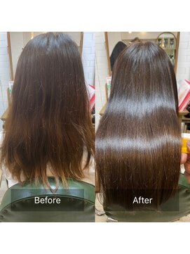 クート(ku-to+) 産後のうねり改善！