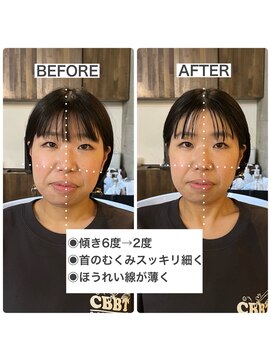 アンドワン(and...one) 骨格補正ヘッドスパ