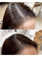 個室×ヒト幹細胞で根本から若々しい“強髪”ケア
