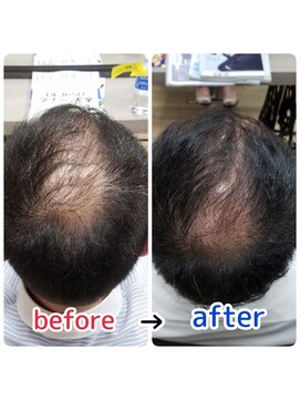 ルーミールーム(RoomieRoom) 頭皮改善！育毛促進ケア！