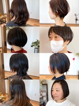 ロトヘアー(Roto hair) Before After