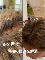 アンプレヴーアジュテ(Impre'vu ajoute)&nbsp;頭皮改善