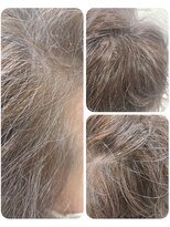 ユーフォルムギンザ(y-Forme Ginza)&nbsp;カラーエステ/白髪ぼかしカラー♪