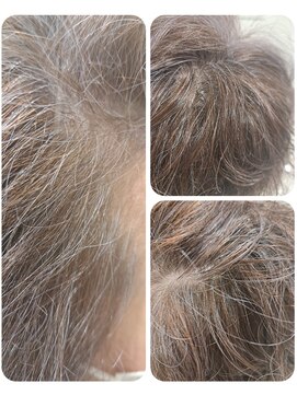 ユーフォルムギンザ(y-Forme Ginza) カラーエステ/白髪ぼかしカラー♪