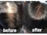 【髪の抜け毛解消♪】期間限定★頭皮改善の育毛を促進する体験コース￥9900