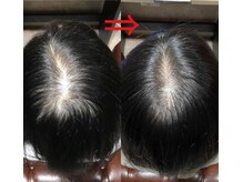 ベリンダ(BELINDA)の雰囲気（育毛促進ケアで、太くて抜けにくい髪の毛を育てていきます♪）