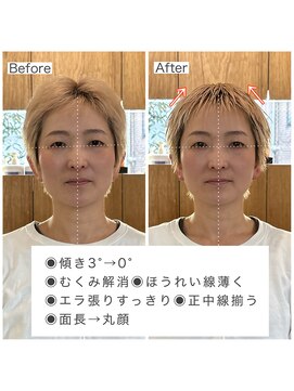 シャウルデッサントウキョウ 表参道(CHARLES DESSIN Tokyo) 整顔スパでむくみケア