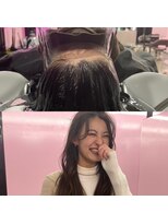 キジ(KIJI) 頭浸浴デトックスケア