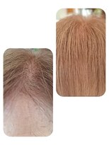 ユーフォルムギンザ(y-Forme Ginza)&nbsp;話題のトキカタ♪前髪編