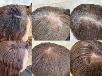 イツキ ヘアーデザイン(ITSUKI hair design)の写真/【白髪は活かす時代へ】白髪染めを使わない脱白髪染め。白髪ぼかしブリーチ施術も。白髪のお悩み解消します
