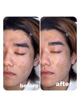 アルコ(ALCO) 垢抜け眉毛パーマ♪ハリウッドブロウリフト&美眉スタイリング