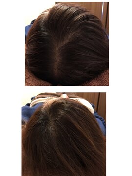 喜介 増毛エクステ