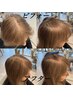 ＜B オススメメニュー＞カット＋明るい白髪染めプレックスカラー 17000円～